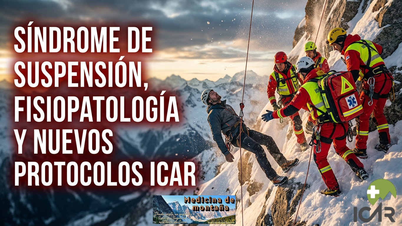 Síndrome de Suspensión, Fisiopatología y Nuevos Protocolos ICAR