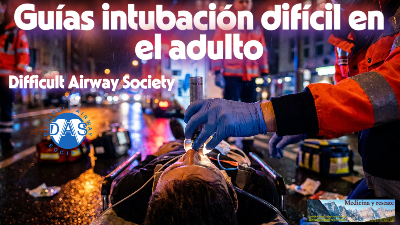 Guías intubación difícil en el adulto - Difficult Airway Society